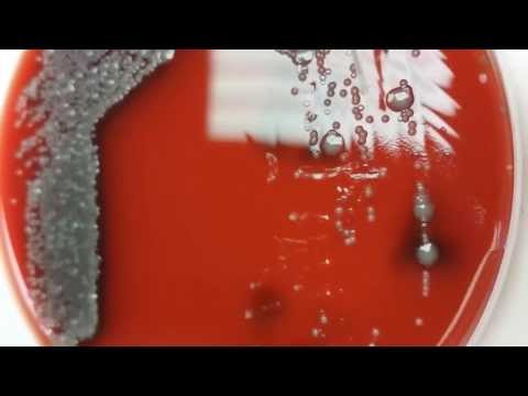 how to isolate neisseria gonorrhoeae