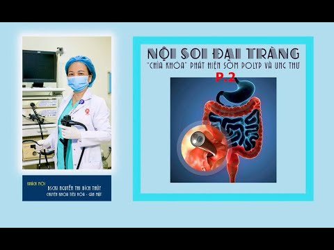 NỘI SOI ĐẠI TRÀNG 