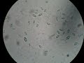 uronema