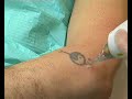 tatuaje
