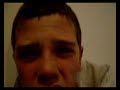 chest infection for facebook mainly :P i hope noone has to suffer this...