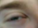 Annoying singing eye Annoying singing eye