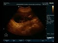 Renatinha + Rafinha = Jo�o Gabriel - Parte_2