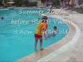 Viktor before and after HBOT