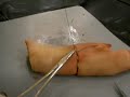 My First Suture My First Suture