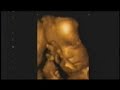 4d-ultrasound.html