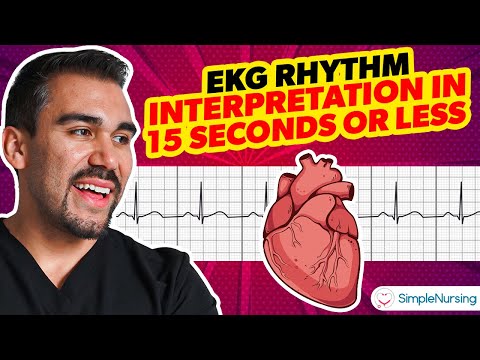 how to read ekg