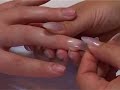 Quick Nail System