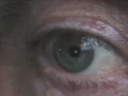 basil bottler eye acting basil bottler eye acting