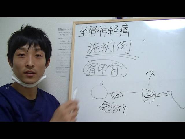 坐骨神経痛の原因 2