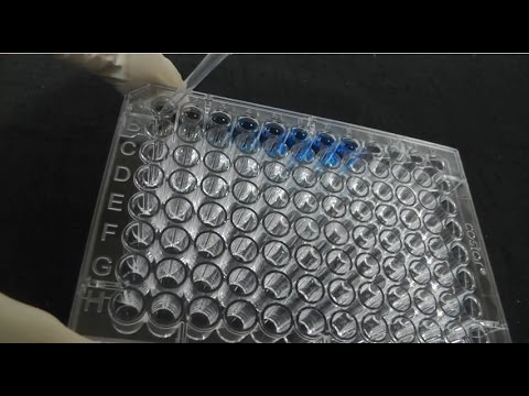 how to perform bradford assay