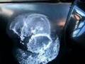 Как удалить вмятину на авто за 3 минуты.<br /><br /> Смотреть видео