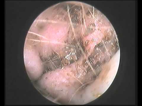 how to eliminate ear mites in dogs