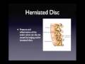 sciatic nerve pain