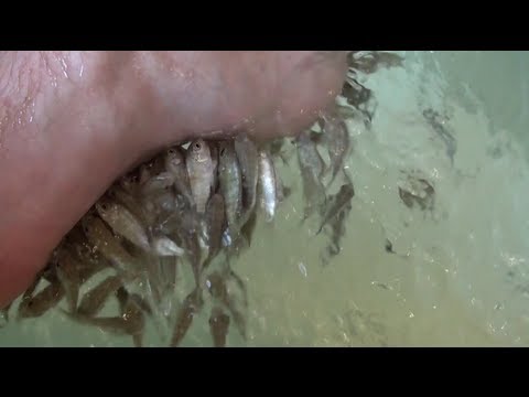 how to remove dead skin from feet