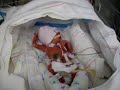 baby jayden 4 monthes premature baby jayden 4 monthes premature