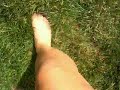 Carlene getting stung by a bee