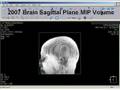 2007 Brain MRI Volumes