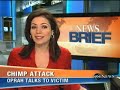 Chimp Attack Survivor Shows Her Face on Oprah