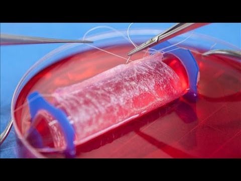 how to transplant organs