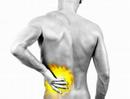 Treating-Back-Pain-B