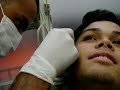 Caio Body Modification (bY Bodin Tattoo)