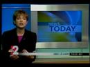 Diet and Dementia Diet and Dementia