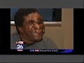 Neurofibromatosis and Reggie Bibbs in the news! Neurofibromatosis and Reggie Bibbs in the news!