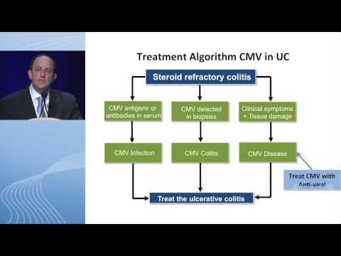 how to treat cmv naturally