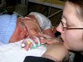 Owen 0-6 months (spina bifida) (cleft lip & palate)