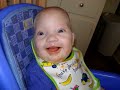 Owen 0-6 months (spina bifida) (cleft lip & palate)