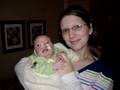 Owen 0-6 months (spina bifida) (cleft lip & palate)