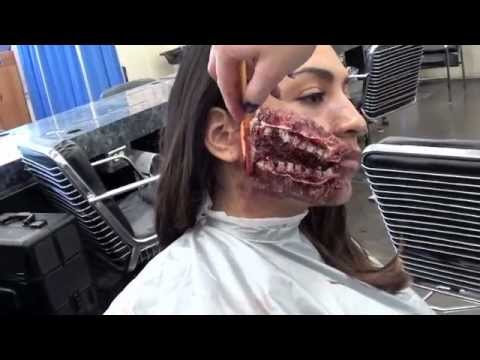how to whiten prosthetic teeth