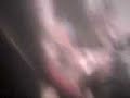 enfermo
