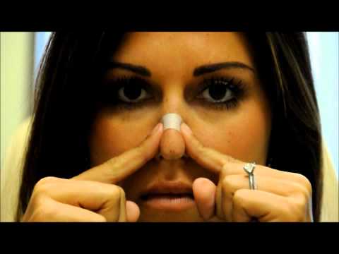 how to properly massage nose after rhinoplasty