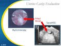 Evaluation of couples before IVF Evaluation of couples before IVF