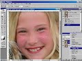 Photoshop sunburn Fix Photoshop sunburn Fix