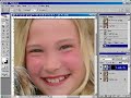Photoshop sunburn Fix