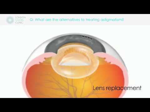 how to treat astigmatism