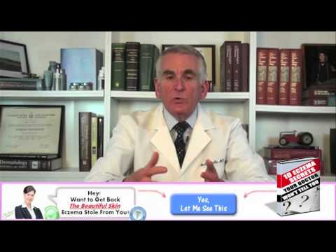 how to control eczema