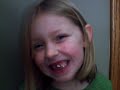 Loose tooth