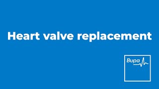 Heart valve replacement