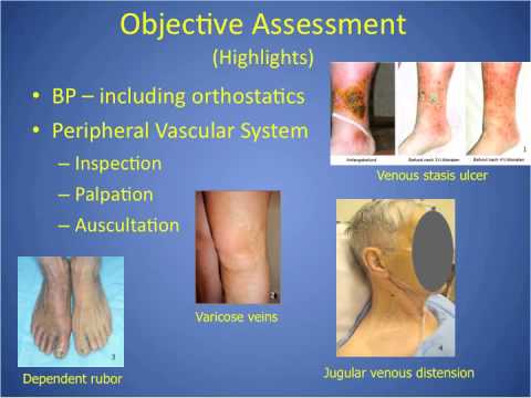 how to assess nursing students