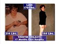 Mehta Bariatric Center infomercial Part 2