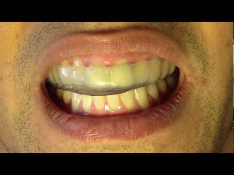 how to administer zoloft