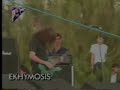 Ekhymosis entrevista con
