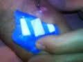kenny-rodgers-botfly.html