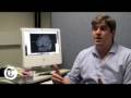 Transcranial Magnetic Stimulation