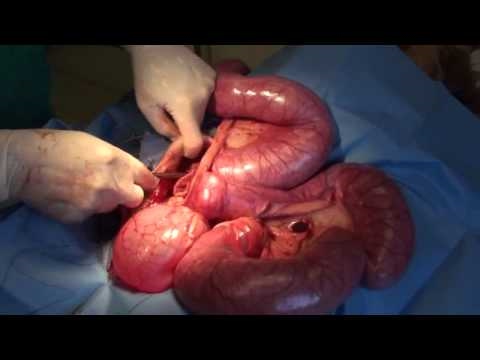 how to locate uterus