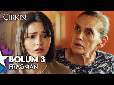 Çirkin 3. Bölüm Fragmanı                                                                                                                                                                                                                                  